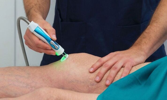 termografia kolenného kĺbu s artrózou